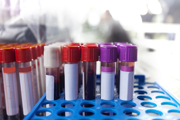 Pegalis Law Group recommends routine blood work.