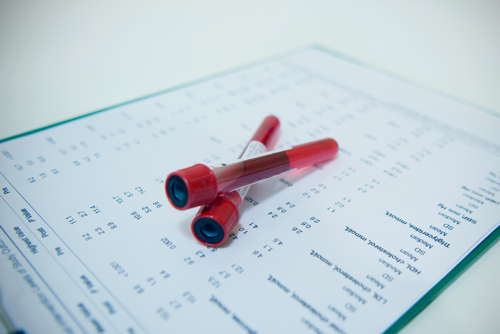 blood vials